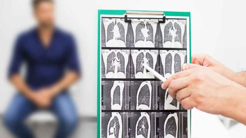 Quais são os tratamentos para fibrose pulmonar